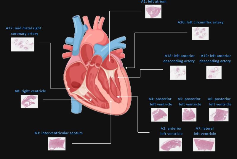 Heart Histology
