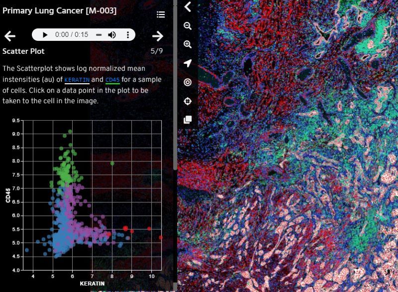 Primary Lung Cancer (Data Analysis)